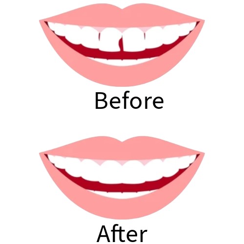 Best dentist and dental clinic for dental cosmetic treatment in hinjewadi Mahalunge Maan Pune