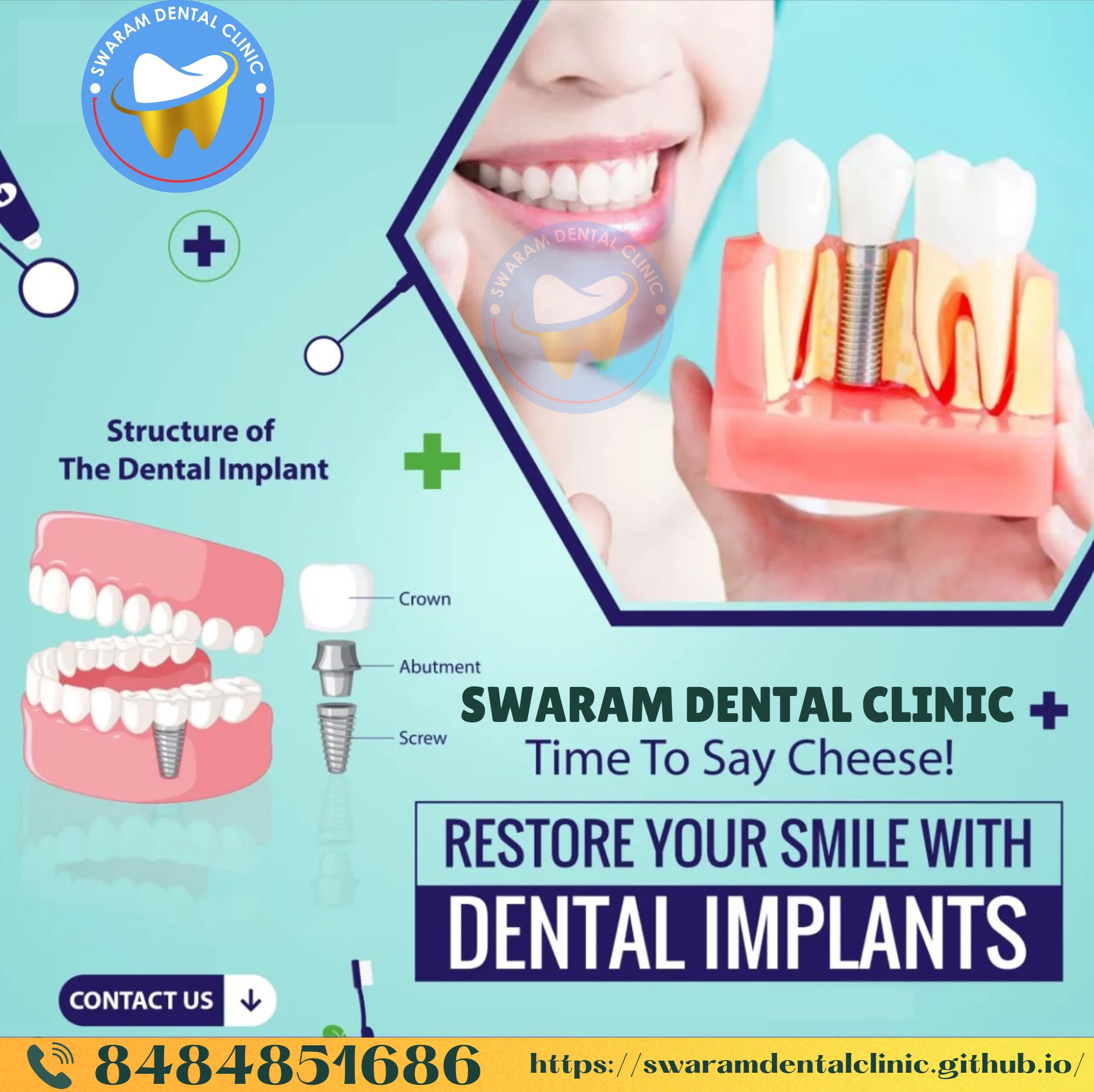 Dental Implant by Best Dentist Near Me in Hinjewadi Pune