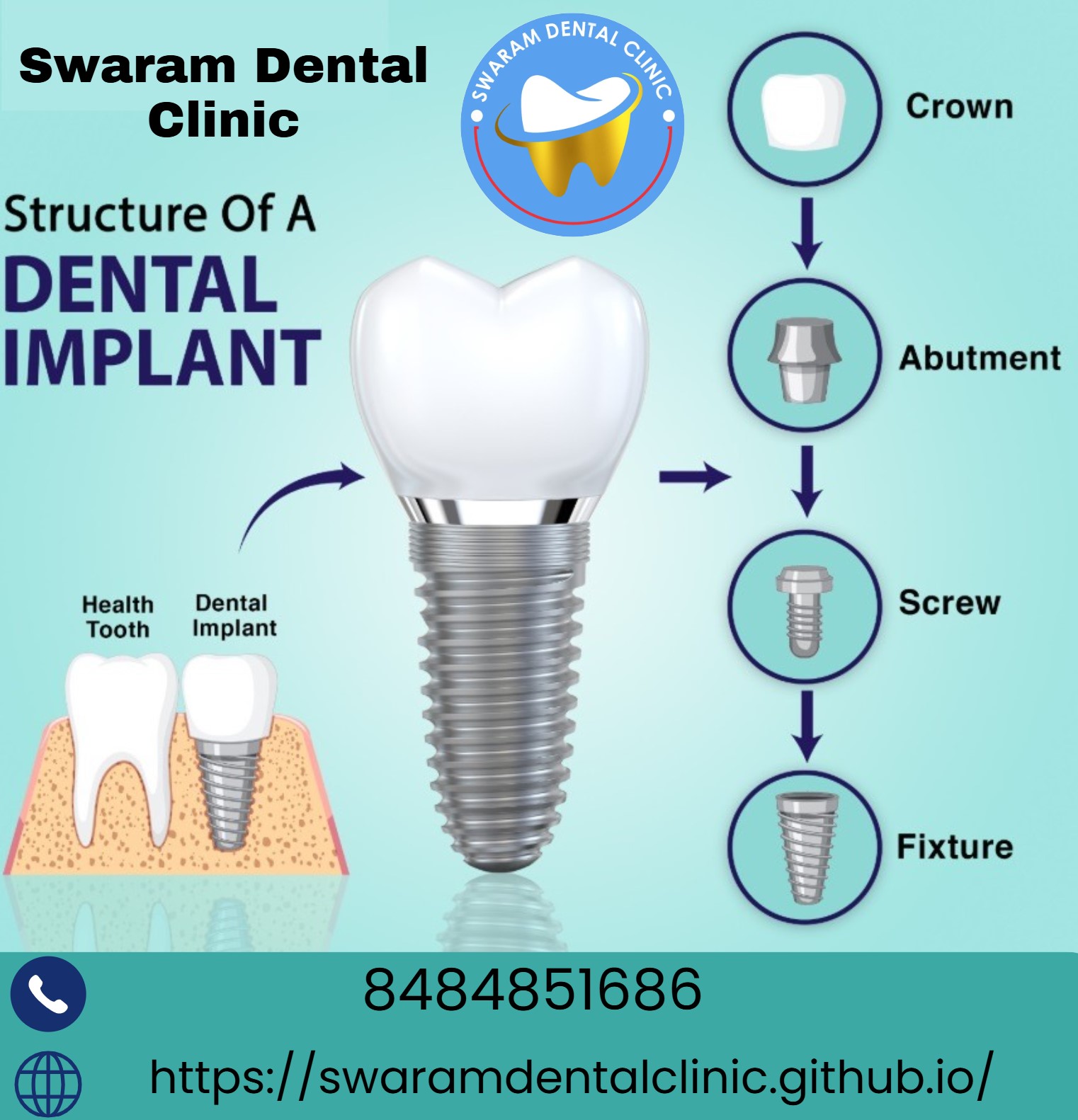 Dental Implant by Dentist Near Me in Hinjewadi