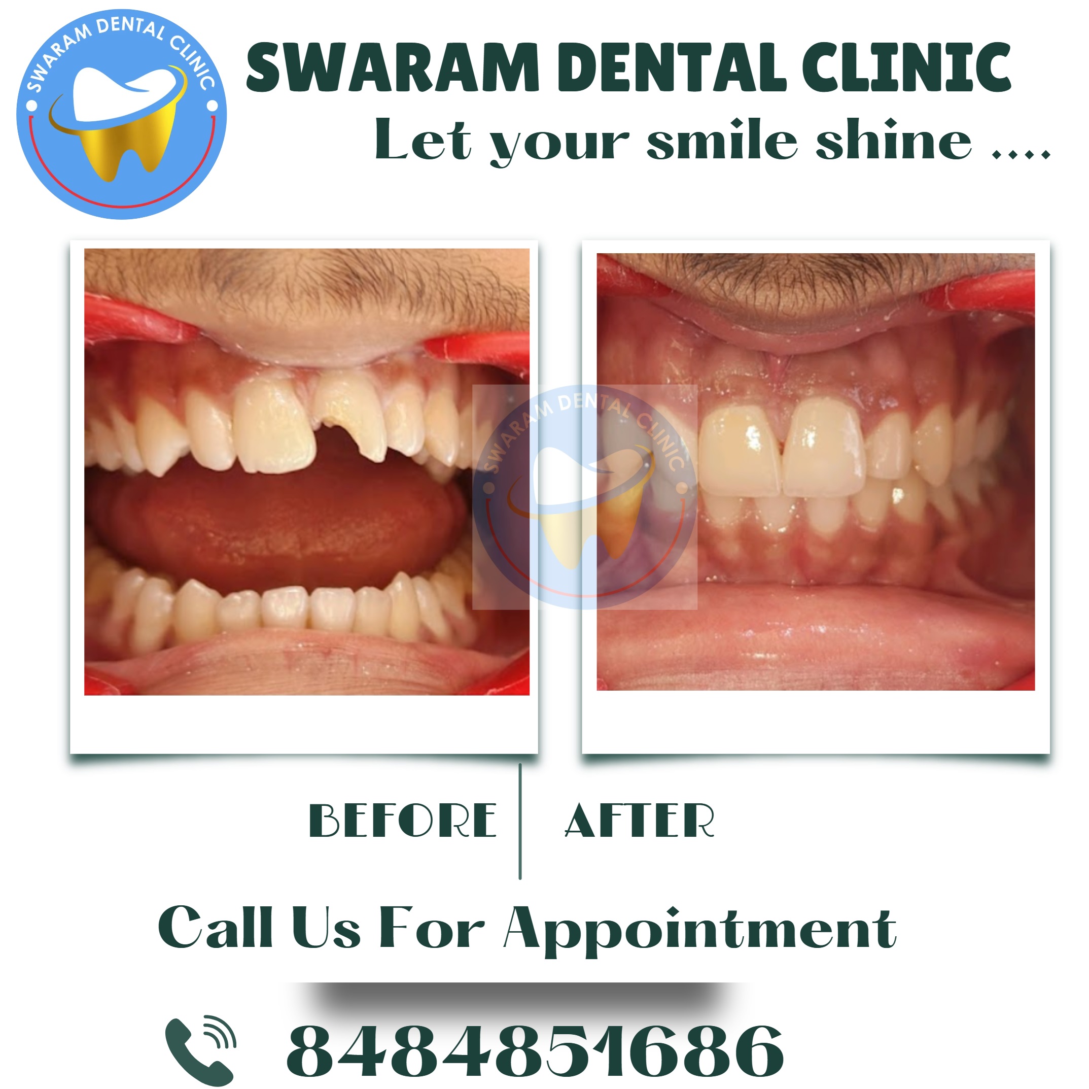 Best Dental Clinic Near Godrej 24 Hinjewadi - Swaram Dental Clinic