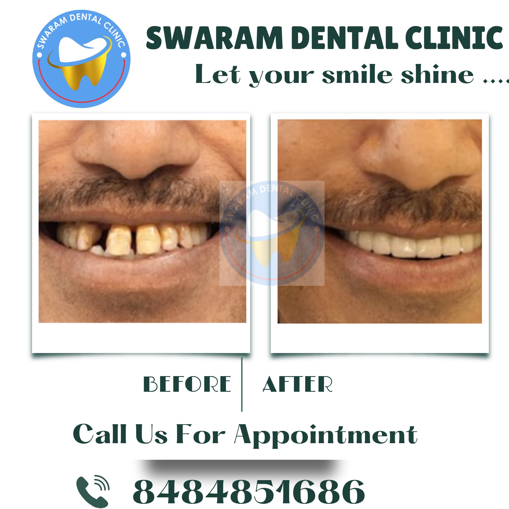 Best Dental Clinic Near Godrej Element Hinjewadi - Swaram Dental Clinic