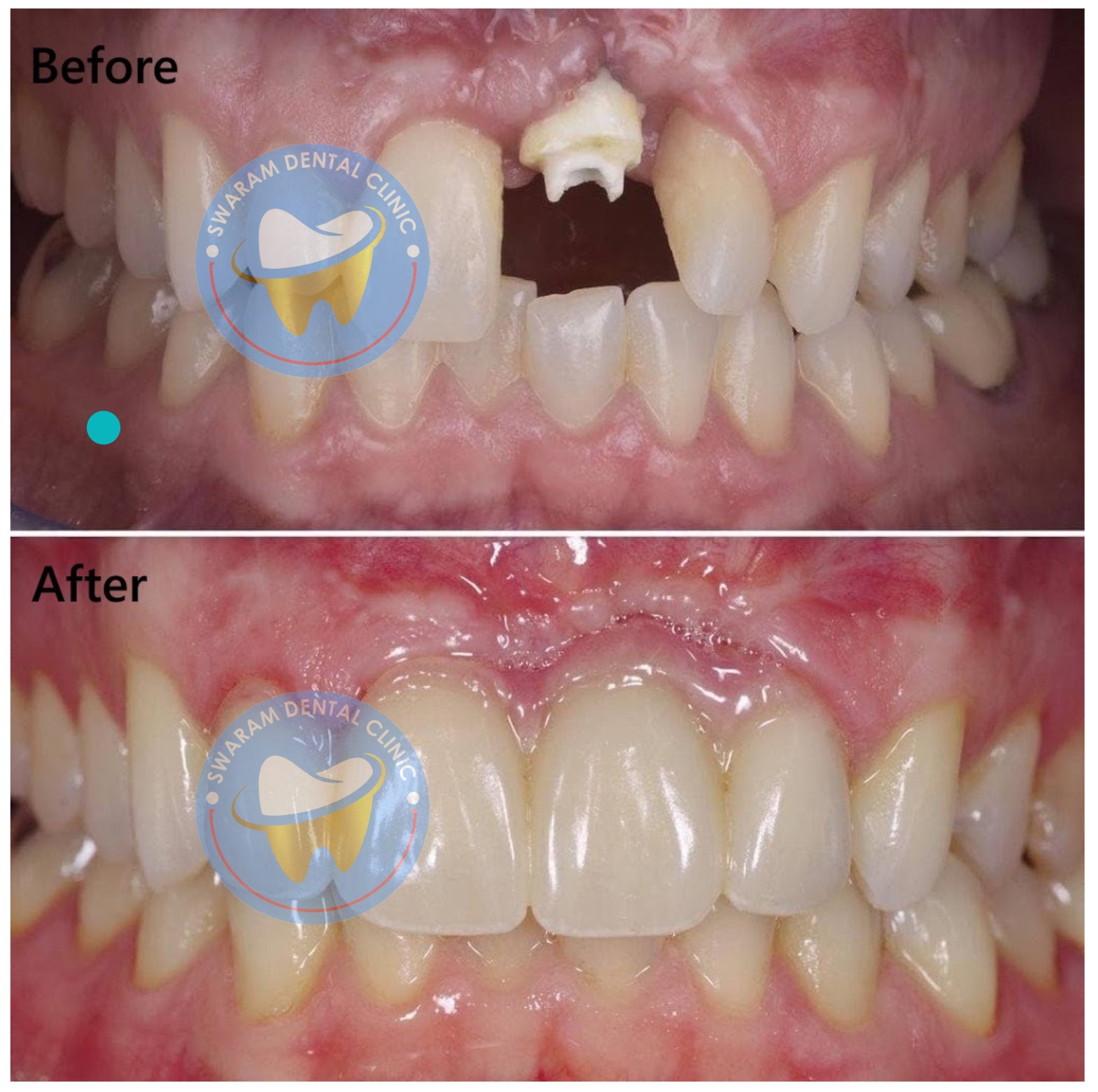 Best Dentist in Hinjewadi Pune Swaram Dental Clinic